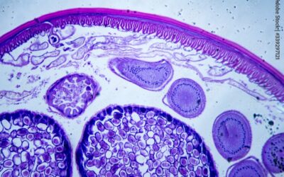 Ocular Toxoplasmosis Vaccine for South America